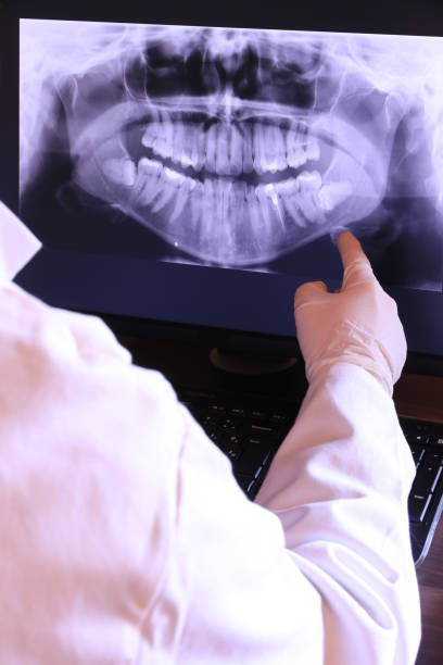 Best Emergency Tooth Extraction  in Lagrange, IN