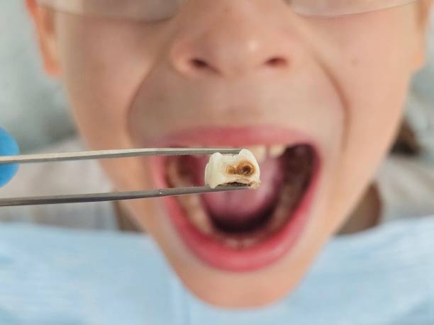 Best Cracked Tooth Emergency Dentist  in Lagrange, IN